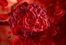 Wissenschaftler erzeugen „Supergerinnsel“, die in Sekundenschnelle aufhören zu bluten