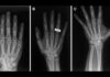 De minuscules rayons X : les premières images en orbite changent la donne pour les randonneurs sur la Lune et les cliniques rurales